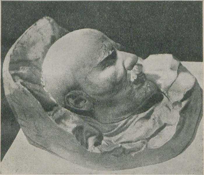 МАСКА В. И. ЛЕНИНА, снятая скульптором С. Меркуловым через несколько часов после кончины Владимира Ильича